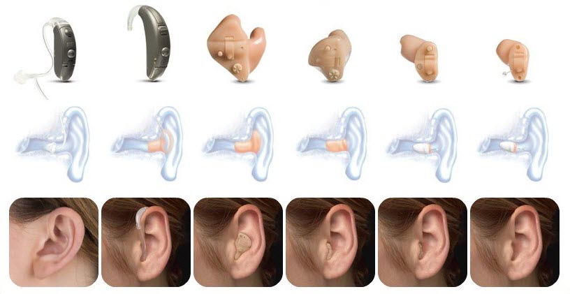 виды слуховых аппаратов 